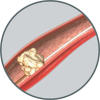 XFilter-Steps-1 XFilter-Steps-1