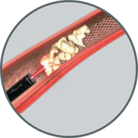 XFilter-Steps-3 XFilter-Steps-3